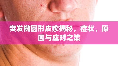 突发椭圆形皮疹揭秘，症状、原因与应对之策