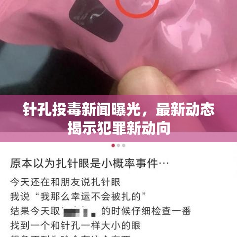 针孔投毒新闻曝光，最新动态揭示犯罪新动向